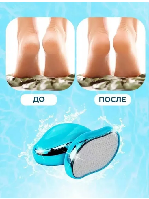 Пемза - Терка для ног Профессиональная пемза для ног и пяток, голубой, фото 7