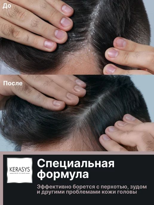 KERASYS Мужской шампунь для волос от перхоти Лечение кожи головы, вариант, фото 4