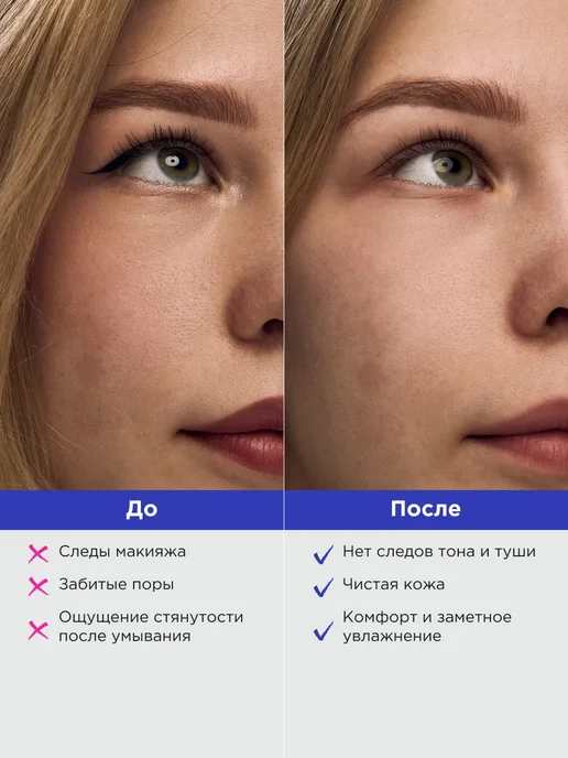 VOIS Гидрофильный бальзам щербет для снятия макияжа, вариант, фото 3