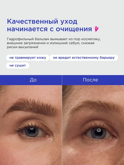 VOIS Гидрофильный бальзам щербет для снятия макияжа, вариант, фото 5