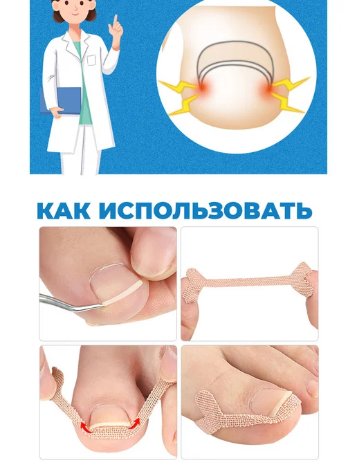 Luxottire Корректор фиксатор для вросшего ногтя пластырь корректор, серый, фото 7