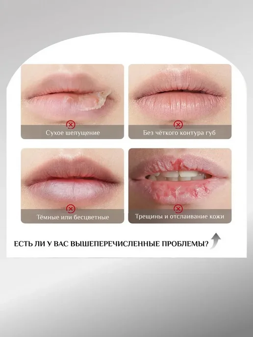 SPARCLI Бальзам для губ увлажняющий от трещин, вариант, фото 6