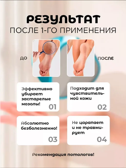 Пемза - Терка для ног пемза для ног и депилятор для удаление волоса, вариант, фото 5