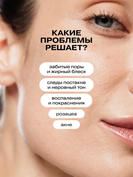 Openface Тоник лосьон для лица от прыщей No Red Flags, красный, фото 2