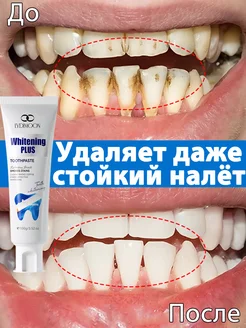 Зубная паста, от загрязнений, против кариеса LYDIMOON 315470285 купить за 1 201 ₽ в интернет‑магазине Wildberries