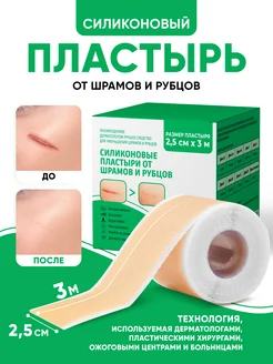 Силиконовый пластырь от шрамов и рубцов 2,5 см х 300 см ELVISH 316293392 купить за 648 ₽ в интернет‑магазине Wildberries