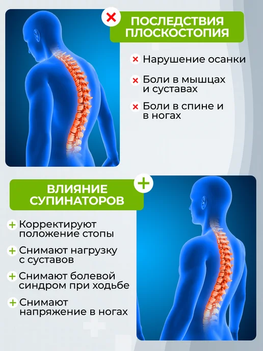 FactForce Супинаторы ортопедические стельки при плоскостопии, вариант, фото 2