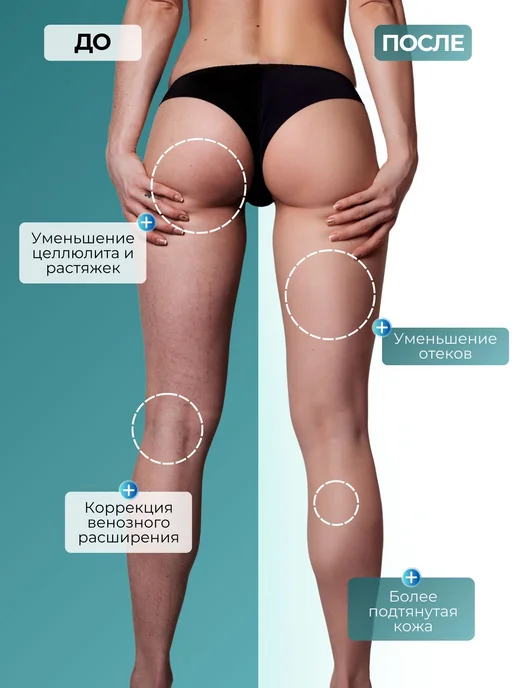 BBalance BASIC Кинезио тейп для тела 5см*5м, бежевый, голубой, фото 3