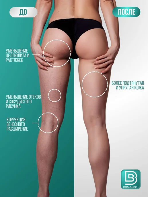 BBalance BASIC Кинезио тейп для тела 5см*5м, бежевый, розовый, фото 3