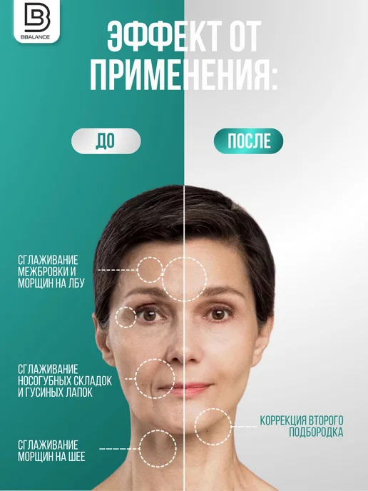 BBalance BASIC Кинезио тейп для тела 5см*5м, бежевый, розовый, фото 5