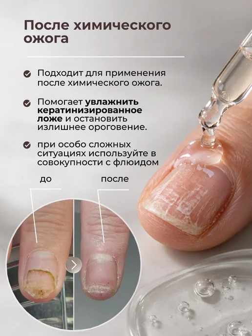 KANE PROFESSIONAL Кератолик для ногтей, удаления кутикулы, грубой кожи, вариант, фото 8