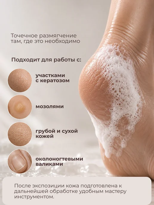 KANE PROFESSIONAL Средство для размягчения грубой кожи с мочевиной, вариант, фото 5