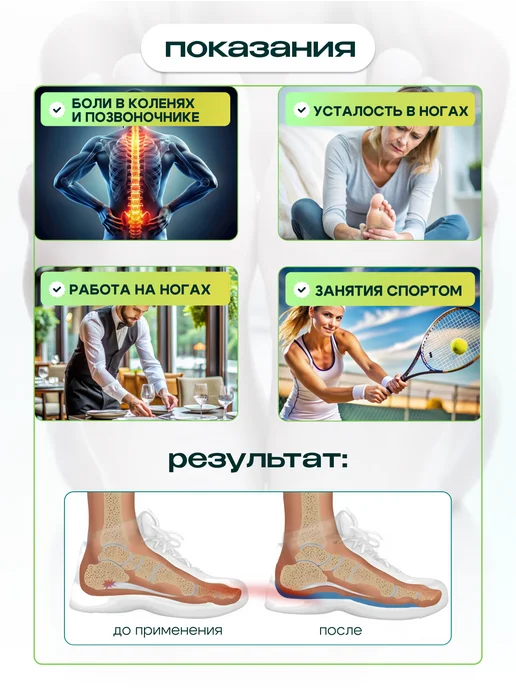 MyBalance Стельки ортопедические массажные, синий, фото 2