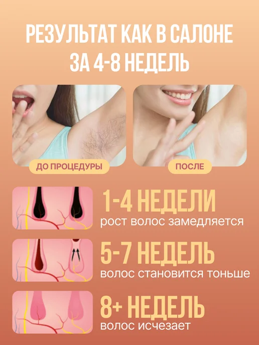 LUM AUS Фотоэпилятор лазерный для удаления волос профессиональный, белый, фото 2