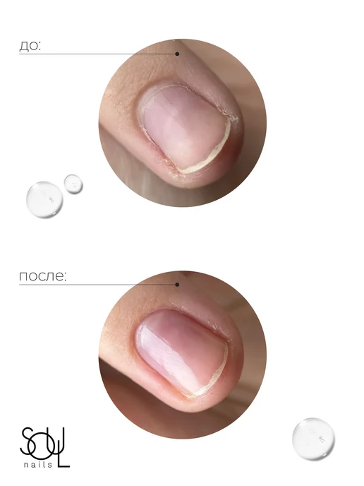 SOULnails Гель ремувер для кутикулы гелеобразный Cuticle Remover, вариант, фото 4